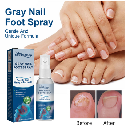 Moisturizing Nail Care for Soft, Dry, and Odor-Free Nails